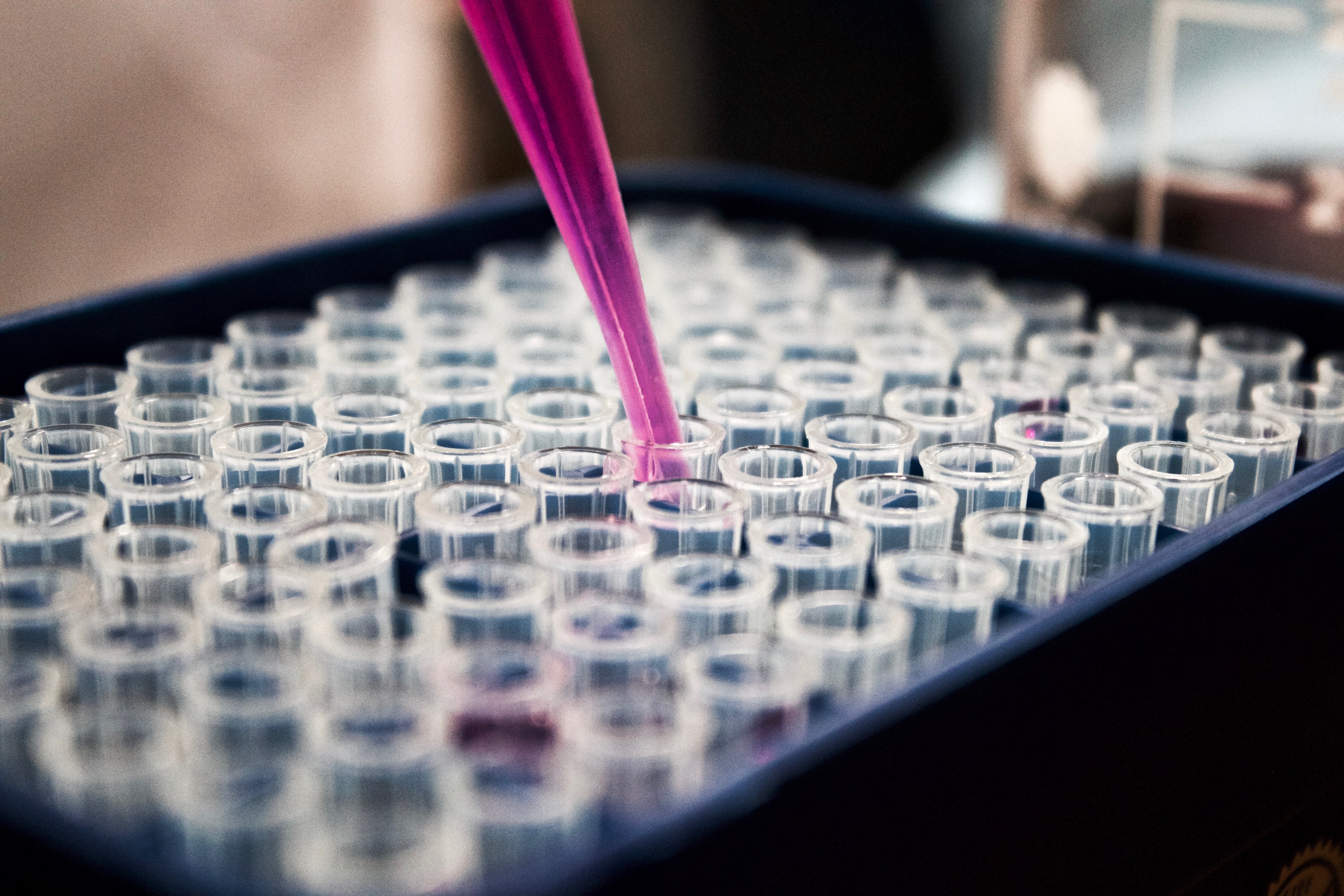Advancements in Parkinson’s Early Detection